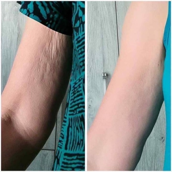 ageLOC® Dermatic Effects™ Body Contouring Lotion/Hibiscus Firming Cream - Picture 9 of 10